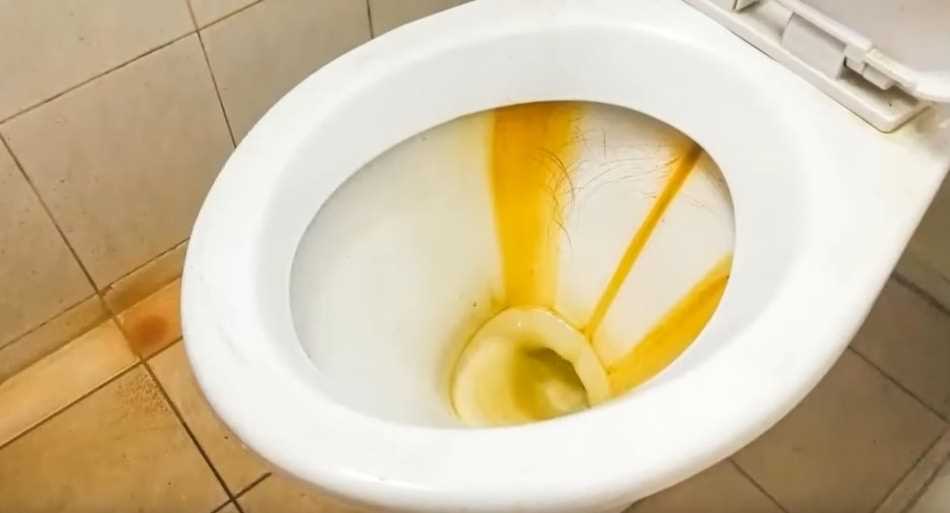 Why Hard Water Can Lead to Yellow Stains on Toilet Seats